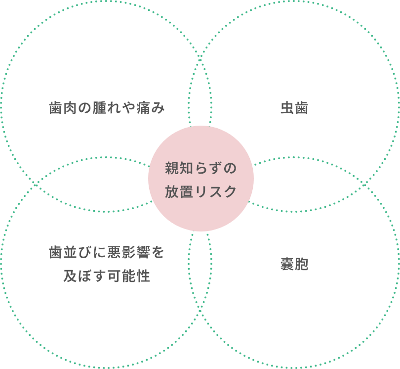 親知らずの放置リスク（歯肉の腫れや痛み・虫歯・歯並びに悪影響を及ぼす可能性・嚢胞）