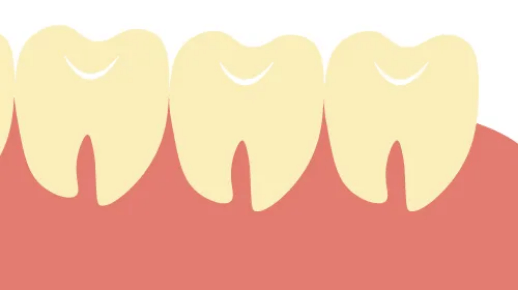 イラスト：親知らずがまっすぐに生えている